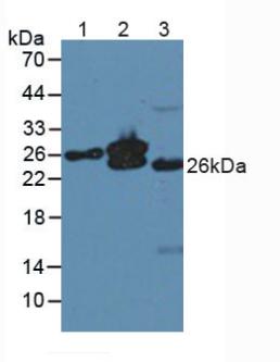 肌球蛋白輕鏈4(MYL4)多克隆抗體