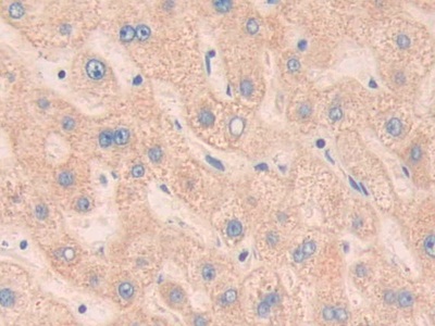 肌球蛋白ⅠC(MYO1C)多克隆抗體