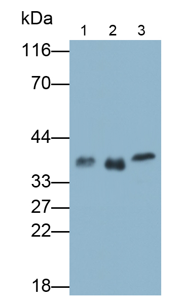 原肌球蛋白2β(TPM2)多克隆抗體
