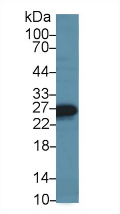 肌球蛋白輕鏈7(MYL7)多克隆抗體