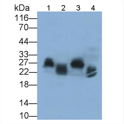 肌球蛋白輕鏈7(MYL7)多克隆抗體