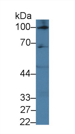 低氧诱导因子2α(HIF2a)多克隆抗体