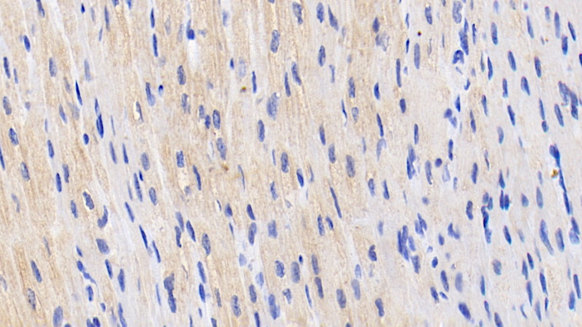 低氧诱导因子2α(HIF2a)多克隆抗体