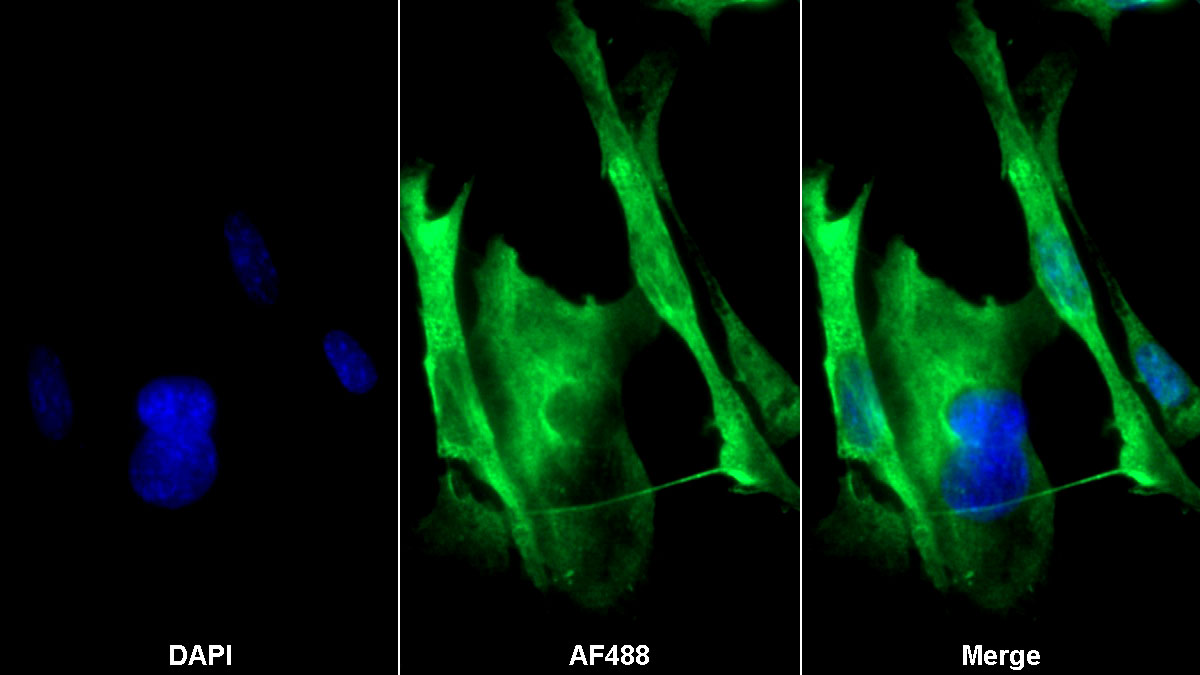 低氧诱导因子2α(HIF2a)多克隆抗体