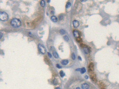 載脂蛋白L2(APOL2)多克隆抗體