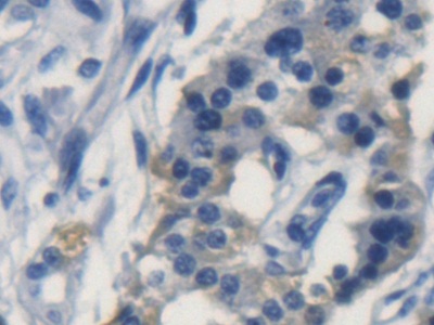 載脂蛋白L2(APOL2)多克隆抗體