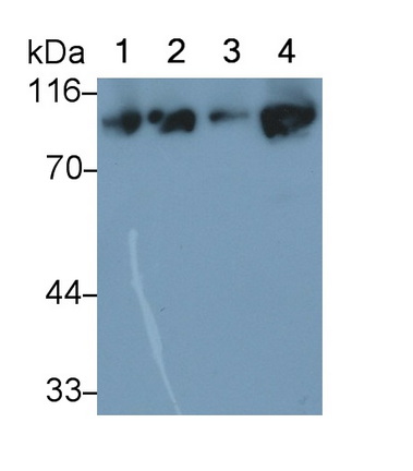 90kDa热休克蛋白αB1(HSP90aB1)多克隆抗体
