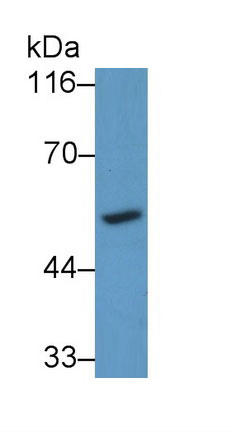 細胞色素P450家族成員26A1(CYP26A1)多克隆抗體