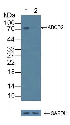 ATP结合盒转运蛋白D2(ABCD2)多克隆抗体