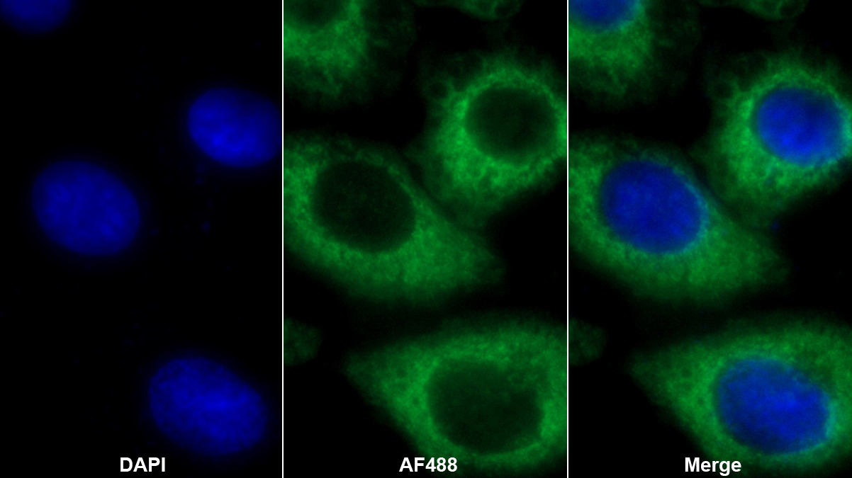 乙酰輔酶A乙酰轉(zhuǎn)移酶1(ACAT1)多克隆抗體