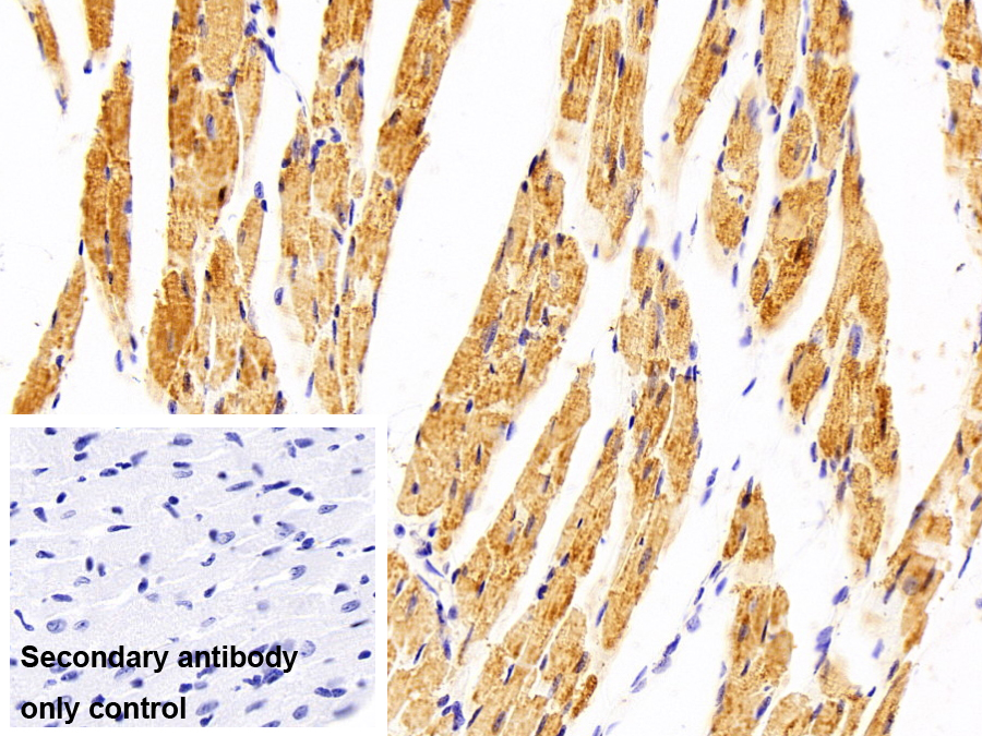 ?；o酶A合成酶長(zhǎng)鏈家族成員1(ACSL1)多克隆抗體