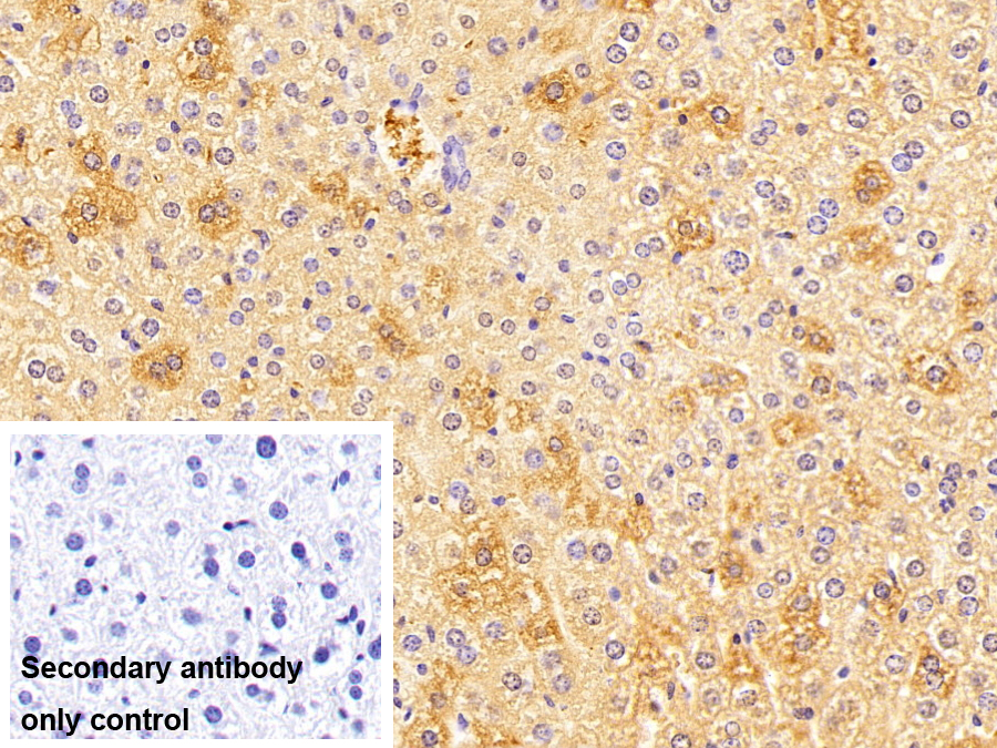 ?；o酶A合成酶長(zhǎng)鏈家族成員1(ACSL1)多克隆抗體