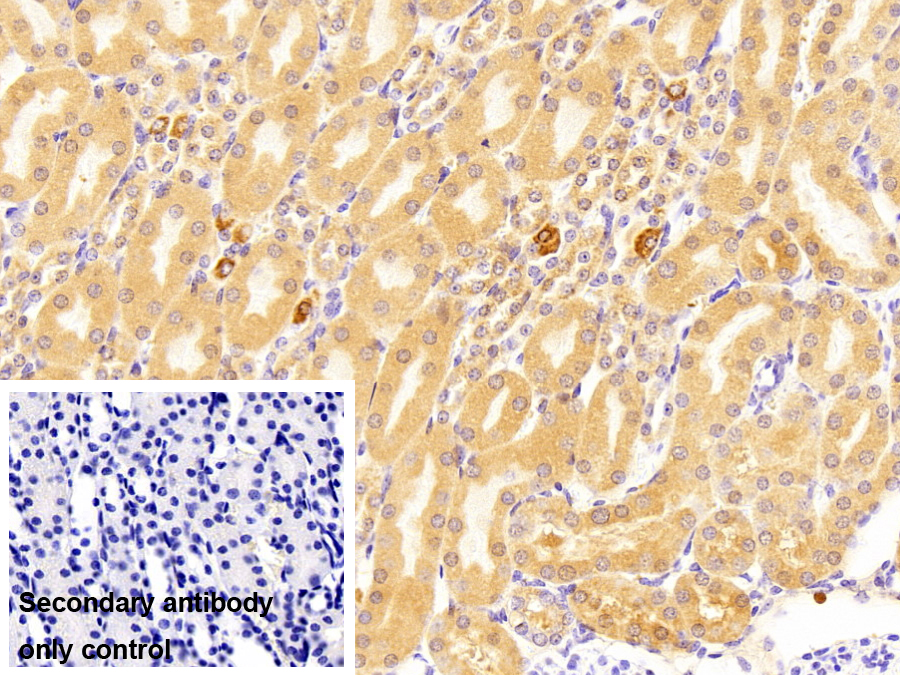 ?；o酶A合成酶長(zhǎng)鏈家族成員1(ACSL1)多克隆抗體