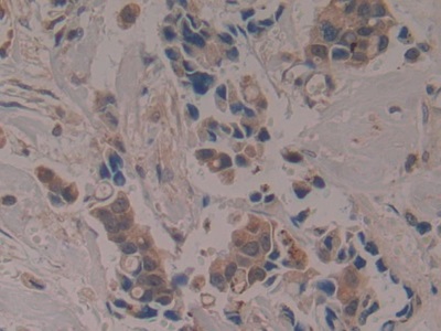 載脂蛋白A1結(jié)合蛋白(APOA1BP)多克隆抗體