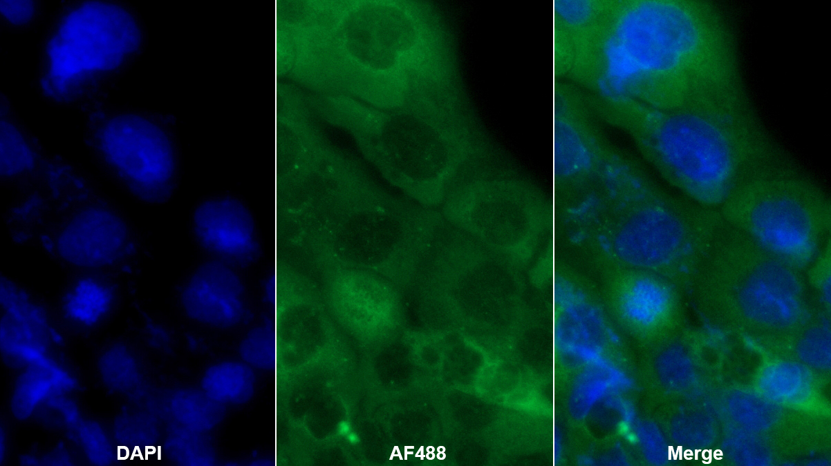 载脂蛋白L1(APOL1)多克隆抗体