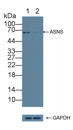 天冬酰胺合成酶(ASNS)多克隆抗体