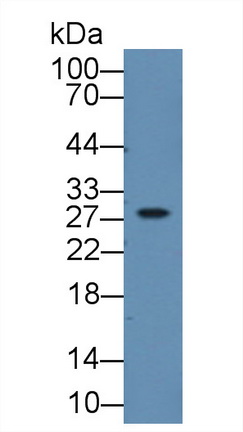 类胰蛋白酶β2(TPSb2)多克隆抗体