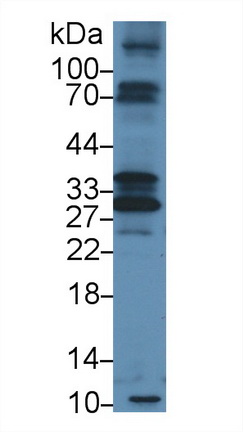 类胰蛋白酶β2(TPSb2)多克隆抗体