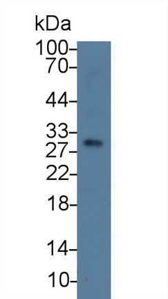 类胰蛋白酶β2(TPSb2)多克隆抗体