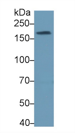 拓扑异构酶Ⅱ结合蛋白1(TOPBP1)多克隆抗体