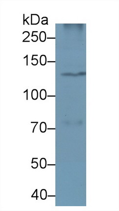 磷酯酶Cβ4(PLCb4)多克隆抗體