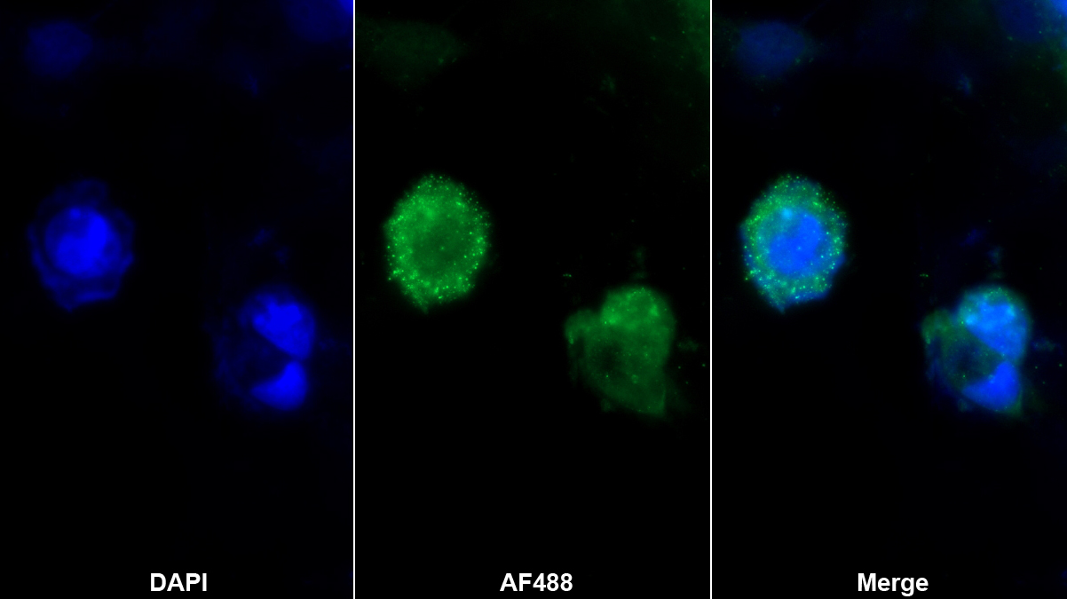 二肽基肽酶3(DPP3)多克隆抗体