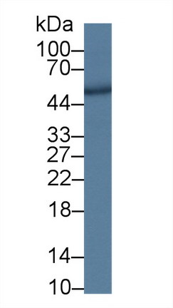 二肽基肽酶7(DPP7)多克隆抗体
