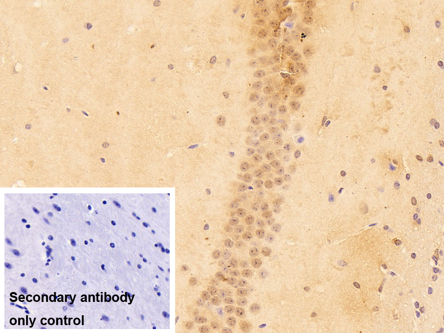 小核糖核蛋白多肽D3(SNRPD3)多克隆抗體