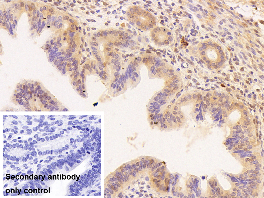 小核糖核蛋白多肽D3(SNRPD3)多克隆抗體
