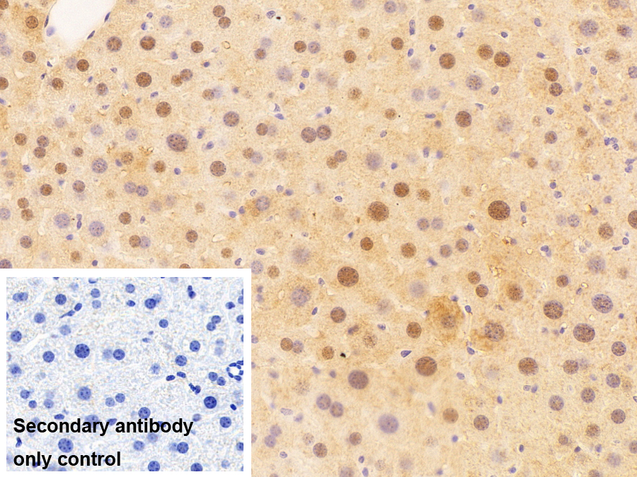 小核糖核蛋白多肽D3(SNRPD3)多克隆抗體