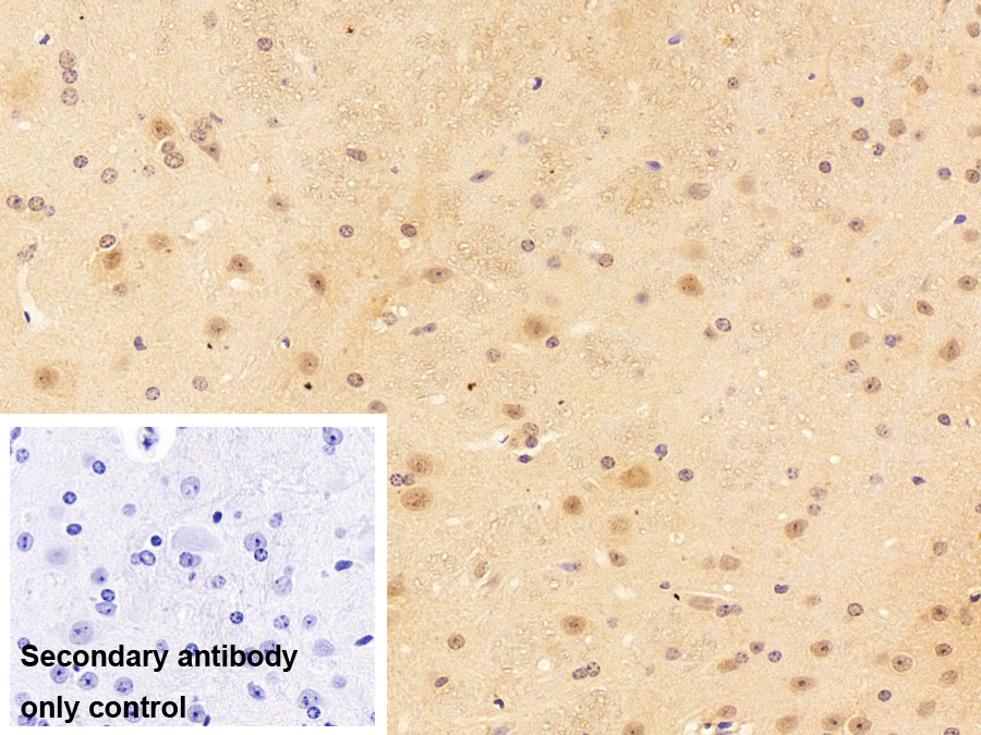 小核糖核蛋白多肽D3(SNRPD3)多克隆抗體