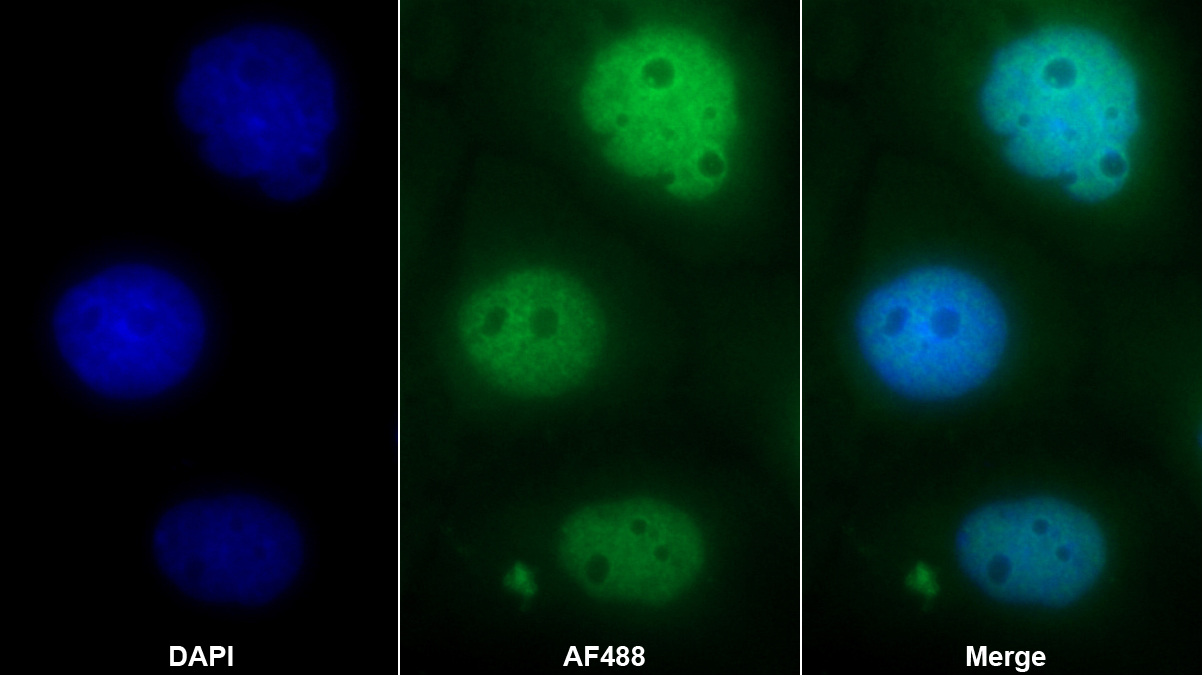 小核糖核蛋白多肽D3(SNRPD3)多克隆抗體