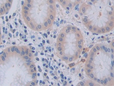 肿瘤坏死因子配体超家族成员9(TNFSF9)多克隆抗体