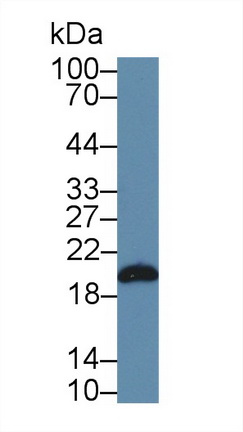 二甲基精氨酸二甲胺水解酶1(DDAH1)多克隆抗體
