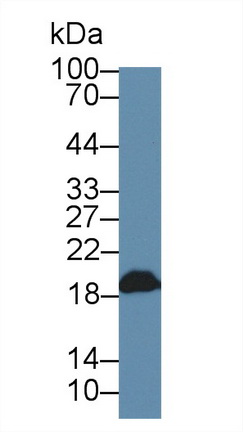 二甲基精氨酸二甲胺水解酶1(DDAH1)多克隆抗體
