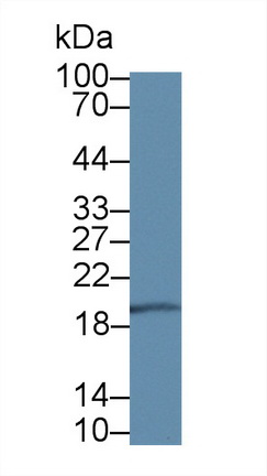 二甲基精氨酸二甲胺水解酶1(DDAH1)多克隆抗體