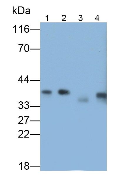 蛋白磷酸酶1催化亞基β亞型(PPP1Cb)多克隆抗體