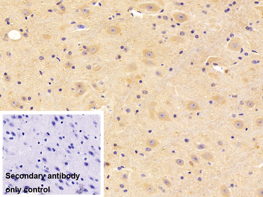 蛋白磷酸酶3催化亞基β亞型(PPP3Cb)多克隆抗體