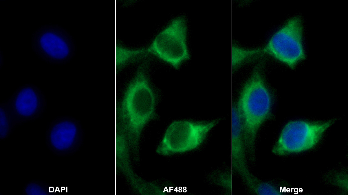围脂滴蛋白3(PLIN3)多克隆抗体