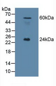 肝配蛋白A1(EFNA1)多克隆抗体