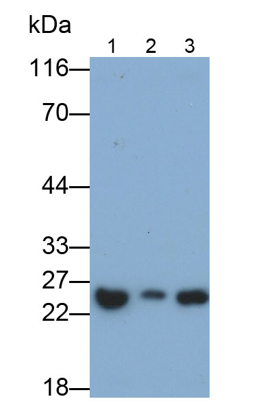 肝配蛋白A5(EFNA5)多克隆抗体