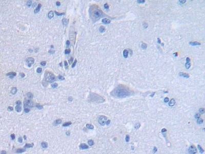 防御素α3(DEFa3)多克隆抗體