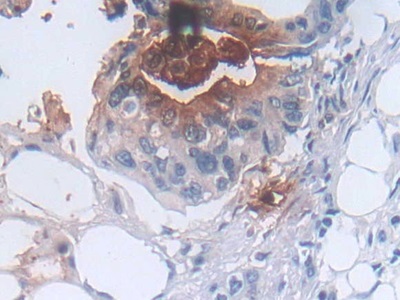 防御素α3(DEFa3)多克隆抗體