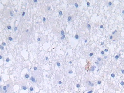 防御素α3(DEFa3)多克隆抗體