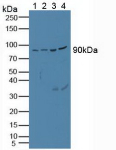 前蛋白转化酶枯草溶菌素1(PCSK1)多克隆抗体
