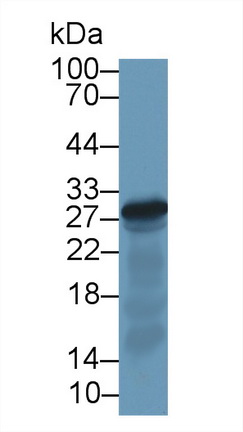 弹性蛋白酶3A(ELA3A)多克隆抗体