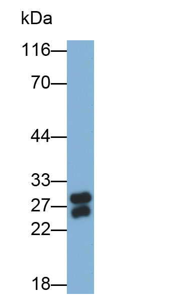 弹性蛋白酶3B(ELA3B)多克隆抗体