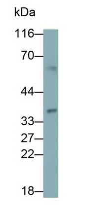 β-胡萝卜素-15,15'-单加氧酶1(bCMO1)多克隆抗体