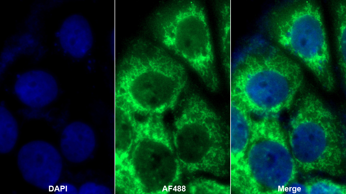 尿黑酸1,2-雙加氧酶(HGD)多克隆抗體