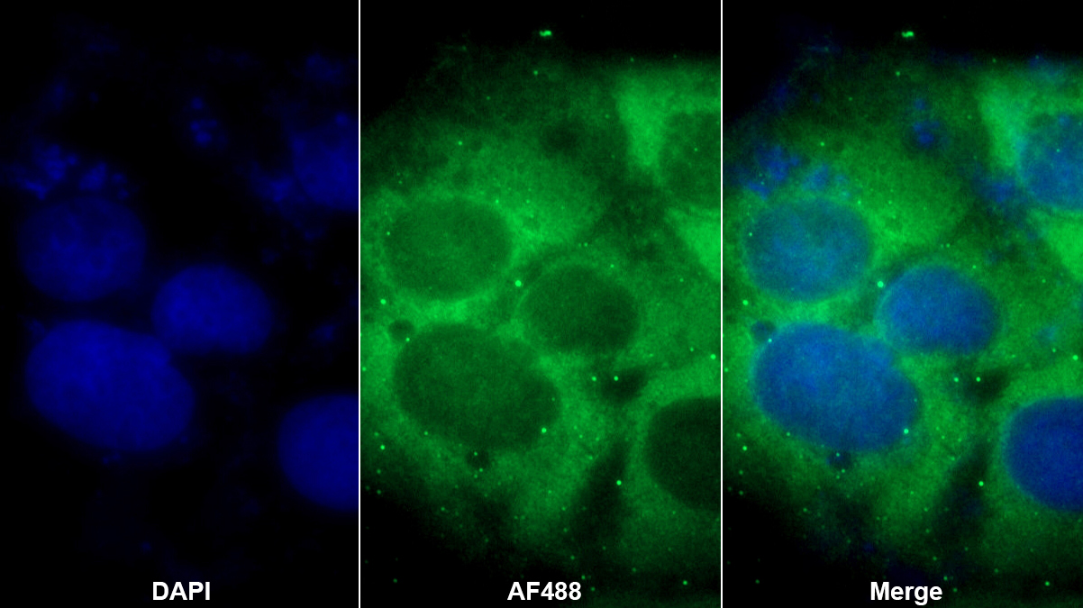 尿黑酸1,2-雙加氧酶(HGD)多克隆抗體